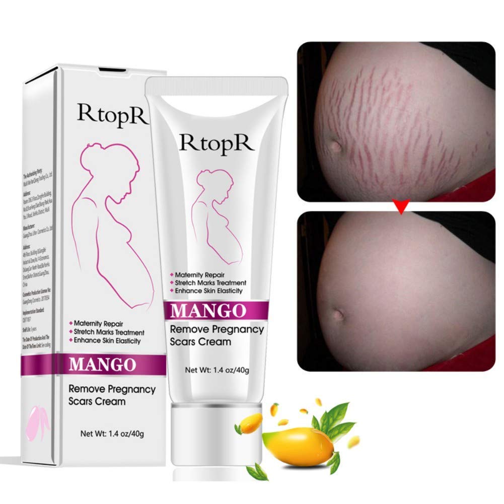 30% Rabatt Cocohot Mango entfernen Schwangerschaft Narben Creme Mutterschaft Reparatur Dehnungsstreifen Skin Repair  für 2.44€ 