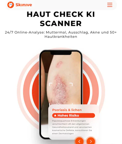 Skinive - Kostenlose Hautscanner App